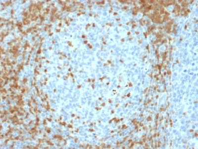 Formalin-fixed, paraffin embedded human tonsil sections stained with 100 ul anti-ZAP70 (clone ZAP70/2035) at 1:50. HIER epitope retrieval prior to staining was performed in 10mM Citrate, pH 6.0.